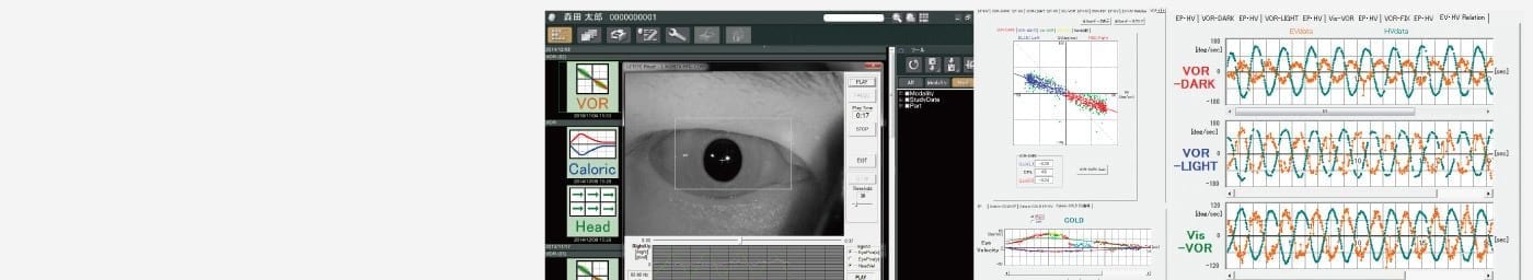 眼球運動検査機器/平衡機能検査システム ニスタモ21